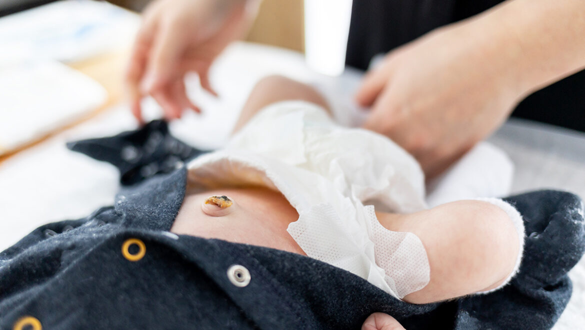 Cuidado del ombligo del recién nacido:  Pasos Esenciales para mantenerlo sano y Prevenir Infecciones